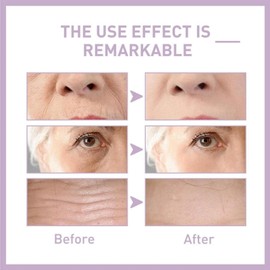 Brightening Serum,Moisturiser Face,Anti Aging Serum For Face,Serum For Skin Brightening,Face Oils And Serums,Hydrate & Moisturize All Skin Types,Improves Dull And Dehydrated Skin,Reduce Wrinkles