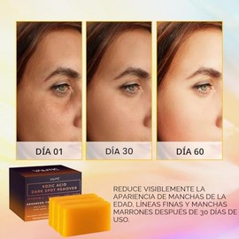 VALITIC Barras de jabón eliminadoras de manchas oscuras de ácido kójico con vitamina C, retinol, colágeno, cúrcuma, complejo japonés original infundid