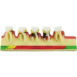 Dental Periodontal Disease assort Tooth Teeth Typodont Study Teaching Model New