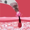 Electric Blackhead Remover Facial Acne Comedo Extractor Rechargeable Blackhead Suction