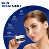 Glycolic Acid Pads - Resurfacing Pads for Face 35% -