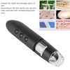 Digital Microscope, 800X Magnification Clear Images Wireless Skin Scalp Detector,