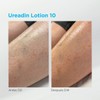 Ureadin Massage Oils 30 ml