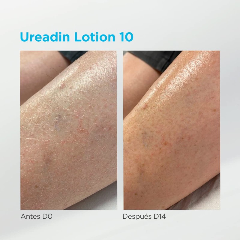 Ureadin Massage Oils 30 ml