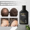 5 Minoxidil Shampoo Crecimiento Con Biotin Y Acondicionador