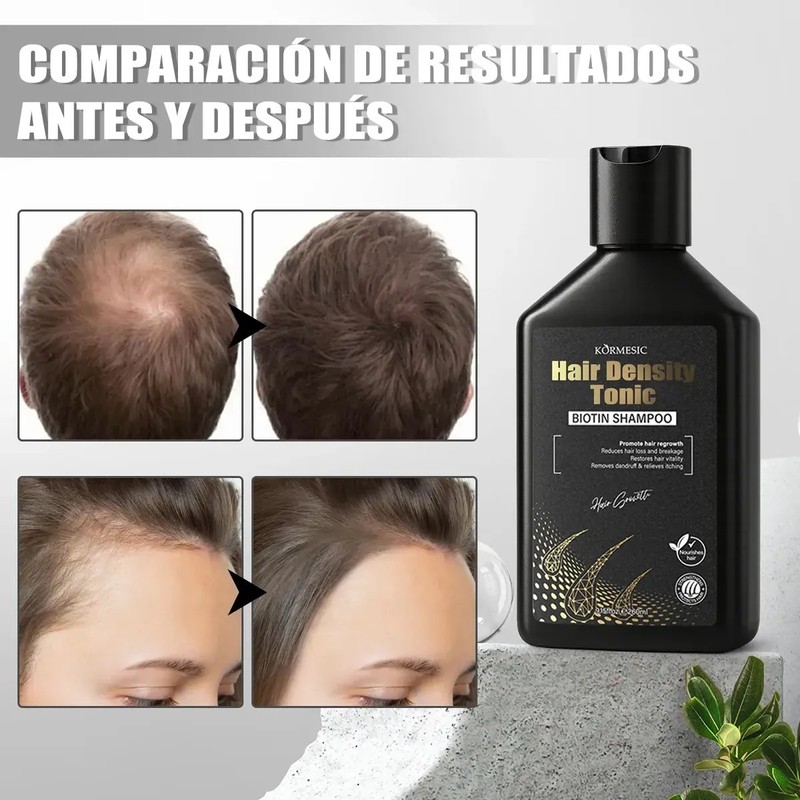 5 Minoxidil Shampoo Crecimiento Con Biotin Y Acondicionador