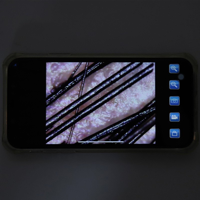 Hair Detector Scalp Skin 2MP Camera 100x WIFI Facial Wireless