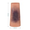 Abrasion and Bruise Wound Care Training Sleeve, Wound Packing Trainer
