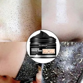 Mascarilla Puntos Negros Carbon De Bambu Limpieza Profunda                                                                                            