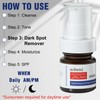 SINPIN aobenz Dark Spot Remover for Face & Body |