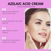 Ouyea Crema Para El Acné Que Contiene Ácido Azelaico