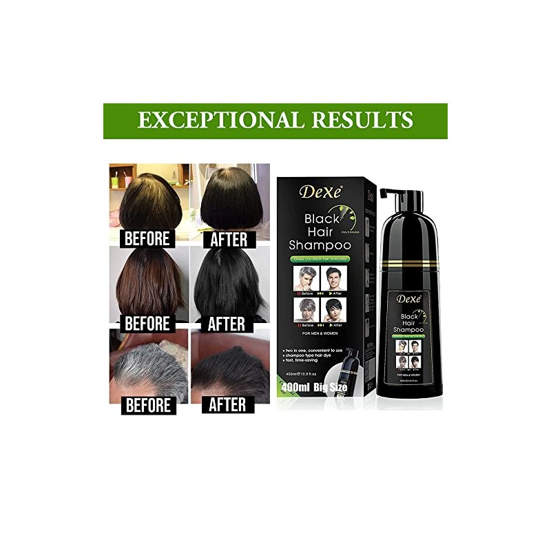 Champú para teñir el cabello Dexe de 14,1 onzas líquidas,