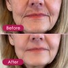 Glabrouse Skin Epilator, Glabrous Skin Hair Remover for Face -