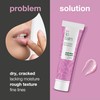 B12 Peptide Lip Treatment for Smooth, Full Lips - Fights