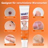 Bellifluous Warzenentferner, Hühneraugen Entferner, 20g Effektiv Dornwarzen Entfernen Fuß, Warzen