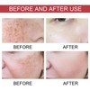 2pcs Dark Spot Correcting Serum with Niacinamide Hyperpigmentation Even Skin