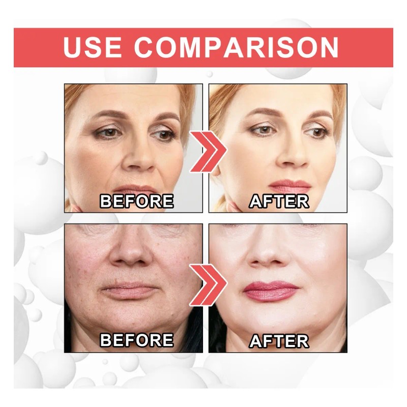 **crema Facial Hidratante De Colágeno For La Piel