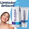 Limpiador Facial Espumoso Elimina Acné Control Piel Grasosa