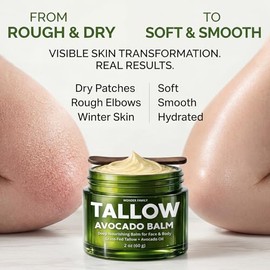 WONDER FAMILY- Bálsamo de sebo y aguacate: a diferencia de la mayoría de los humectantes faciales, nuestra crema facial de sebo de res alimentado con pasto está mejorada con aguacate natural, aceite d