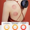 Heating Cupping Therapy Massager Rechargeable 12pcs Stone Needle 9 Leves