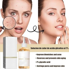 Ácido Glicólico 7% Solución 240ML, Ácido Glicólico 7% Tonifica, Exfolia, Reduce las Marcas del Acné y los Granitos, Rejuvenece la Piel, Un Tónico Facial que lumina tu Cutis.