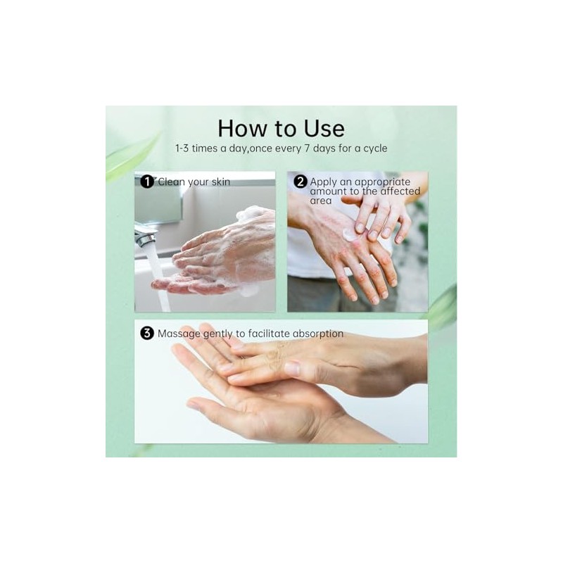 Jendfert 2 Pcs Eczema Cream