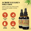 J CROW'S J.Crow's Lugol's Solution of Iodine, 2 Ounce