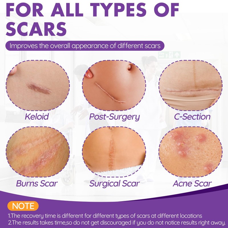Silicone Scar Sheets, Silicone Scar Tape, Reusable Professional Scar Silicone