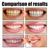 Coconut Oil Pulling for Teeth Whitening-Cocofresha Powerful Organic Coconut Peppermint