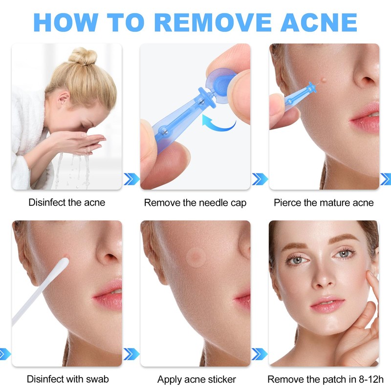 50PCS Disposable Acne Needle & 72 Dots Pimple Stickers -