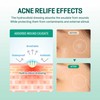 SOME BY MI 30 Days Miracle Clear Spot Patch -