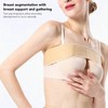 Breast Implant Stabilizer Band 3D Breast Shaping Prevent Outgrowth Side