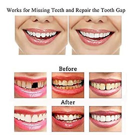 TemptoothR Temporary Tooth Repair Kit-Thermal Beads for Filling Repair the Missing and Brok