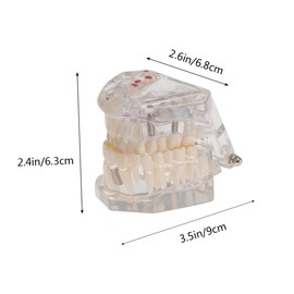 ABOOFAN Detachable Oral Teeth Model for Dental Teaching and Demonstration Removable Parts for Dental Study and Training