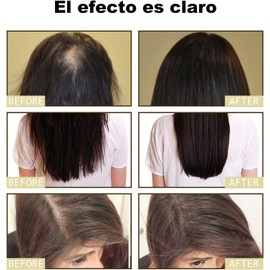 Aceite capilar natural de romero orgánico. Favorece el crecimiento del cabello, reduce la caída y protege la salud del cuero cabelludo (3pcs).
