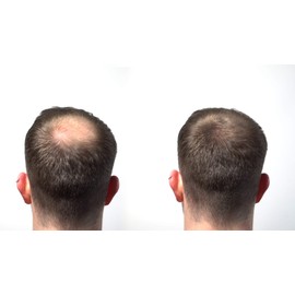 HairLab 100% Organic Hair-Thickening Keratin Fibres for Concealing Hair Loss and Thinning Hair - 30g Dark Brown