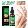 JAYSUING Ginger Nail Care Liquid, Nail Nutrients, Repairs Damaged and