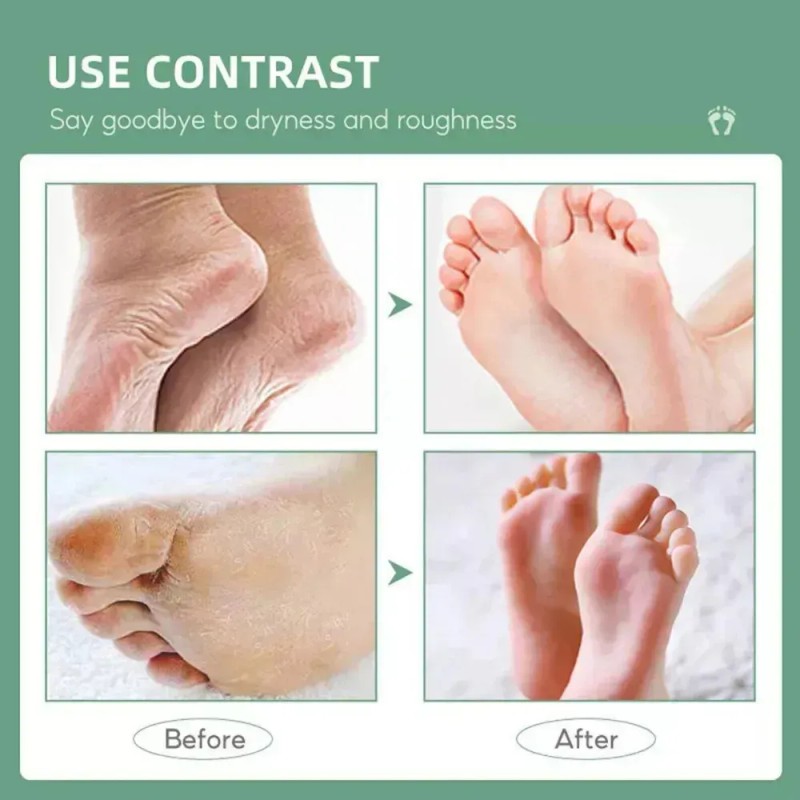 Ff@ La Aj Crema De Urea Al 40% 2% De