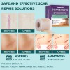 Silicone Scar Sheets,(1.6" X 120" Roll- 3M)Silicone Scar Tape for