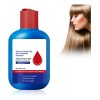 E Champú Anticaspa Oil Control Refrescante Unisex 120 Ml Y