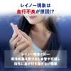 Kiribai Carbon Fiber Hienasu Hand Thermal Holder Main Unit -