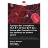 Typage des antigènes HLA-B7 et HLA-B27 des leucocytes humains chez