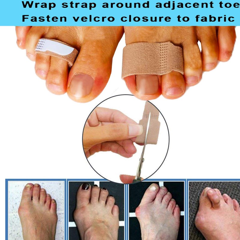 Mcvcoyh Broken Finger Wraps, Finger Buddy Straps, Finger Splint Buddy