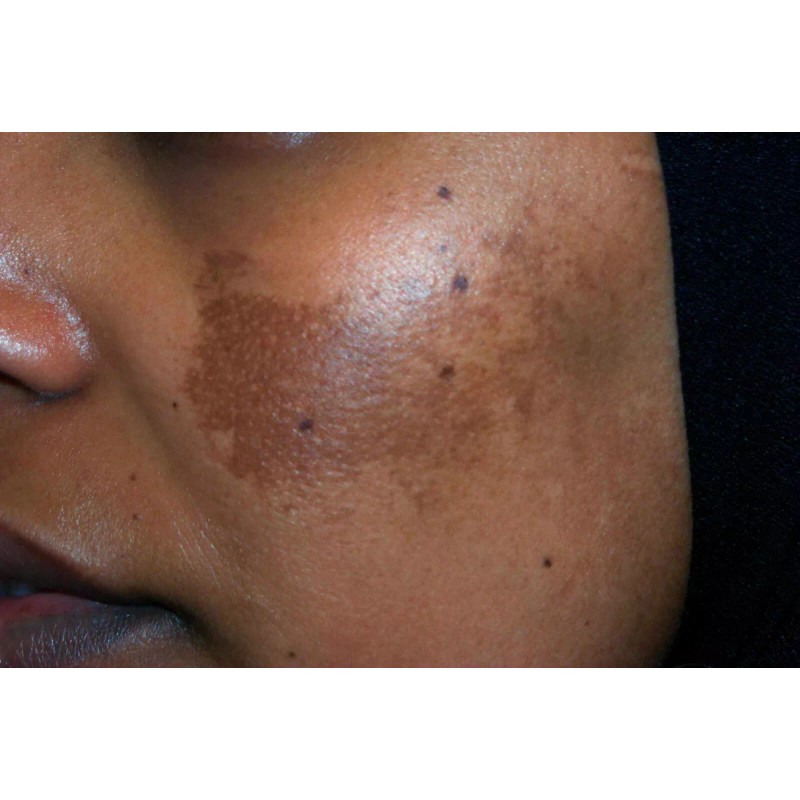 A3 Lemon Face Cream | Brightening & Control Stubborn Blemishes|400