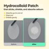 SINSURU SINSURU BHA Iconic Spot Patch - Hydrocolloid Patches with