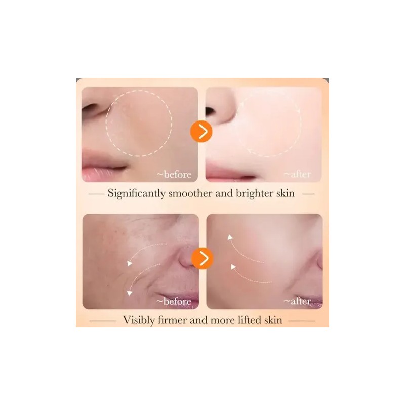 Tratamiento Facial P Manchas Arrugas Ojeras Vc Antiedad 30ml