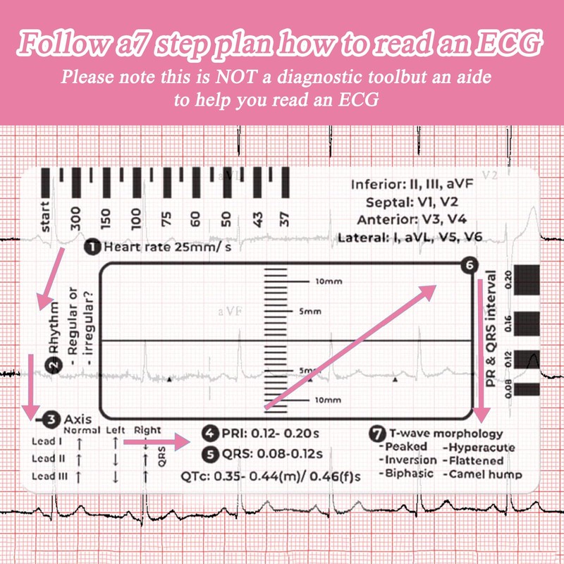 Ecg 7 Step Ruler, Ecg/Ekg 7 Step Ruler Card, Portable