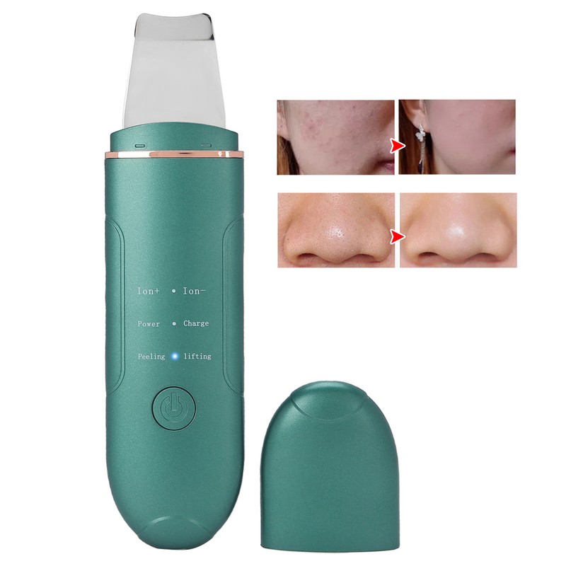 EMS Ultrasonic Skin Scrubber Blackhead Pimple Removal Lifting Ion Pore