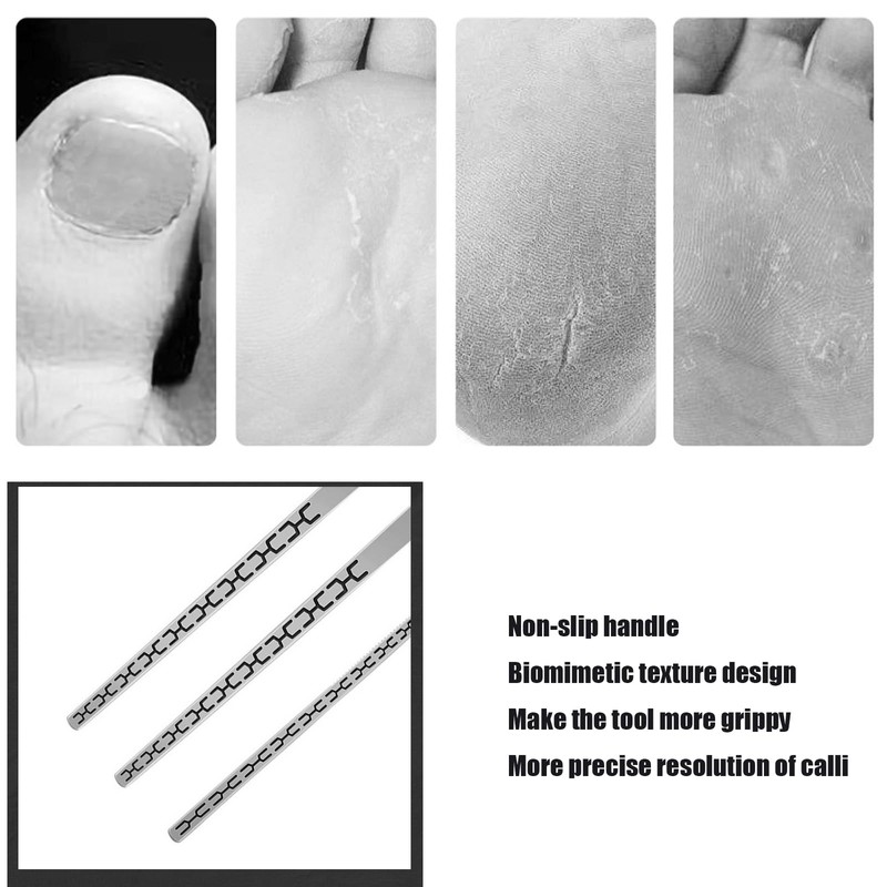 Stainless steel ingrown toenail pedicure knife set,professional foot skin scraper