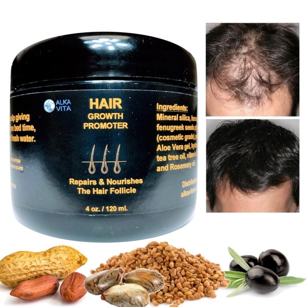 Hair Loss Growth Promoter Alopecia Treatment Silica Fenugreek & Peanut